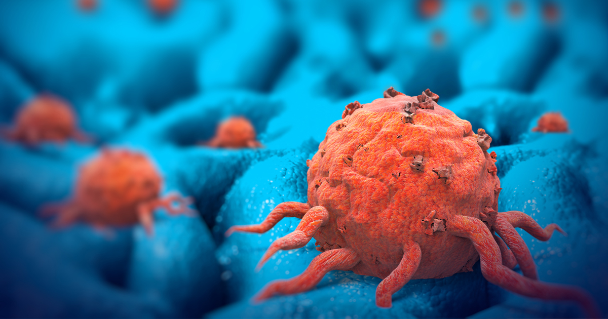 oncology